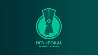 DFB-ePokal: Das ist der Pokal